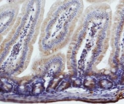 NIK/MAP3K14 Antibody - BSA Free, Novus Biologicals 0.1mL:Antibodies, Polyclonal
