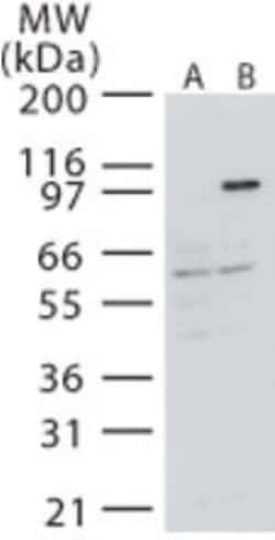 NIK/MAP3K14 Antibody, Novus Biologicals:Antibodies:Primary Antibodies
