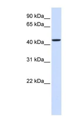 NIPA2 Antibody, Novus Biologicals 100&mu;L; Unlabeled:Antibodies, Polyclonal
