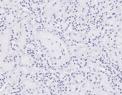 NIPBL Antibody, Novus Biologicals 0.1mg; Unlabeled:Antibodies, Polyclonal
