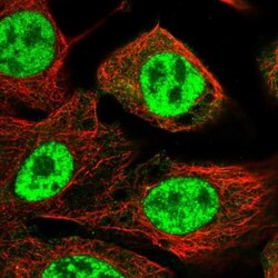 NIPP1 Antibody, Novus Biologicals 0.1mL; Unlabeled:Antibodies, Polyclonal