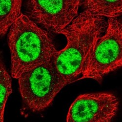 NIPP1 Antibody, Novus Biologicals 0.1mL; Unlabeled:Antibodies, Polyclonal
