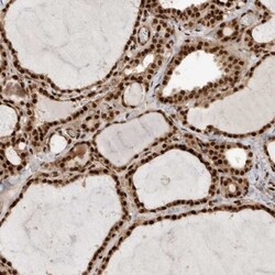 NIPP1 Antibody, Novus Biologicals 0.1mL; Unlabeled:Antibodies, Polyclonal