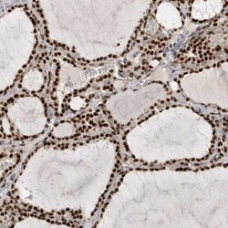NIPP1 Antibody, Novus Biologicals:Antibodies:Primary Antibodies