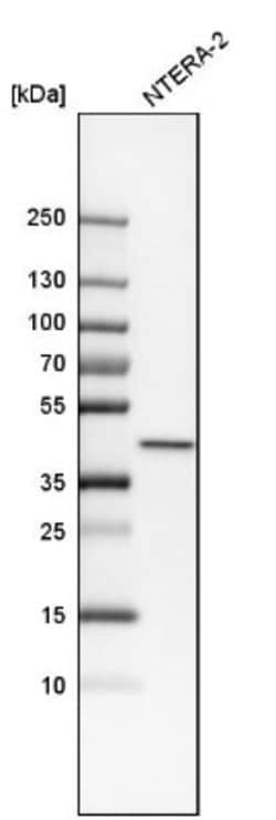 NIPP1 Antibody, Novus Biologicals 0.1mL; Unlabeled:Antibodies, Polyclonal