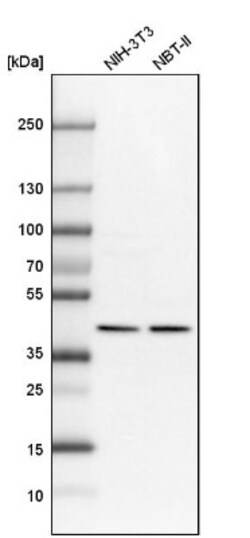 NIPP1 Antibody, Novus Biologicals 0.1mL; Unlabeled:Antibodies, Polyclonal