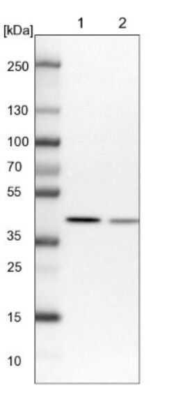 NIPP1 Antibody, Novus Biologicals 0.1mL; Unlabeled:Antibodies, Polyclonal
