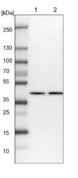 NIPP1 Antibody, Novus Biologicals:Antibodies:Primary Antibodies
