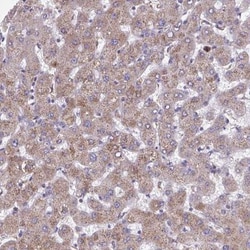 NIPSNAP1 Antibody, Novus Biologicals 0.1mL; Unlabeled:Antibodies, Polyclonal