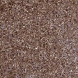 NIT2 Rabbit anti-Human, Polyclonal, Novus Biologicals 25 &mu;g; Unconjugated:Antibodies,