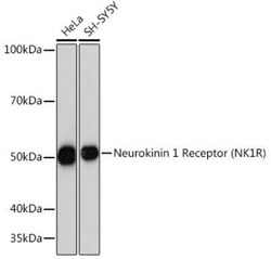 NK1R Rabbit anti-Human, Mouse, Rat, Clone: 9T1W2, Novus Biologicals 20