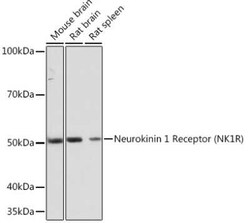 NK1R Rabbit anti-Human, Mouse, Rat, Clone: 9T1W2, Novus Biologicals 20