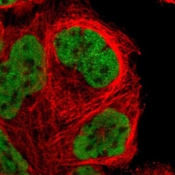 NKAP Antibody, Novus Biologicals 25 &mu;L; Unlabeled:Antibodies, Polyclonal