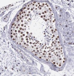 NKAP Antibody, Novus Biologicals 25 &mu;L; Unlabeled:Antibodies, Polyclonal