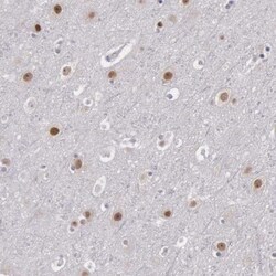 NKAP Antibody, Novus Biologicals 25 &mu;L; Unlabeled:Antibodies, Polyclonal