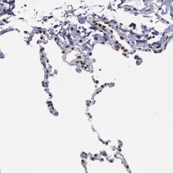 NKAP Antibody, Novus Biologicals 25 &mu;L; Unlabeled:Antibodies, Polyclonal