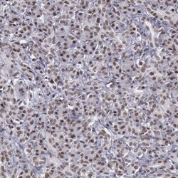 NKAP Antibody, Novus Biologicals 25 &mu;L; Unlabeled:Antibodies, Polyclonal