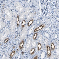 NKCC2/SLC12A1 Antibody, Novus Biologicals:Antibodies:Primary Antibodies