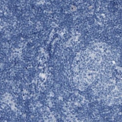 NKCC2/SLC12A1 Antibody, Novus Biologicals:Antibodies:Primary Antibodies