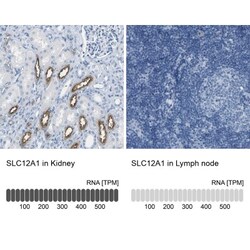 NKCC2/SLC12A1 Antibody, Novus Biologicals:Antibodies:Primary Antibodies