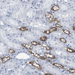 NKCC2/SLC12A1 Antibody, Novus Biologicals:Antibodies:Primary Antibodies