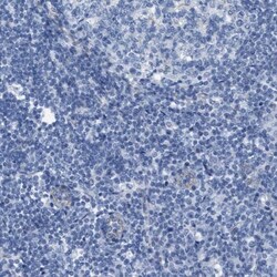 NKCC2/SLC12A1 Antibody, Novus Biologicals:Antibodies:Primary Antibodies