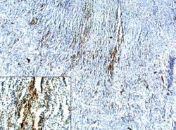 NKCC2/SLC12A1 Antibody, Novus Biologicals 100 &mu;g | Buy Online | Novus Biologicals | Fisher Scientific