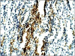 NKCC2/SLC12A1 Antibody, Novus Biologicals 100 &mu;g | Buy Online | Novus Biologicals | Fisher Scientific