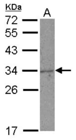 NKG2A/CD159a/KLRC1 Antibody, Novus Biologicals 0.1mL; Unlabeled:Antibodies,