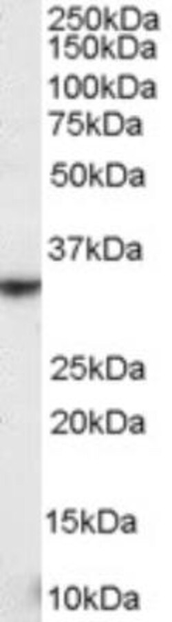 NKG2D/CD314 Antibody, Novus Biologicals 0.1 mg | Buy Online | Novus Biologicals | Fisher Scientific
