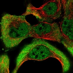 NKTR Antibody, Novus Biologicals 25 &mu;L; Unlabeled:Antibodies, Polyclonal