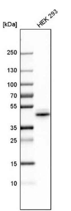NKX6.1 Antibody, Novus Biologicals:Antibodies:Primary Antibodies