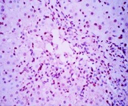 NKp46/NCR1 Antibody (MM0491-8F24) - Azide and BSA Free, Novus Biologicals