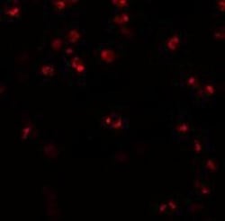 NLRP3/NALP3 Antibody - BSA Free, Novus Biologicals 0.1mg; Unlabeled:Antibodies,