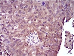 NM23-H2/NME2 Antibody (4G7A8) - BSA Free, Novus Biologicals 0.1mg; Unlabeled:Antibodies,