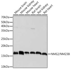 NM23-H2/NME2 Rabbit anti-Mouse, Rat, Clone: 7L3A2, Novus Biologicals 20