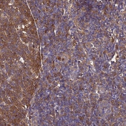 NM23-H1 Antibody, Novus Biologicals:Antibodies:Primary Antibodies