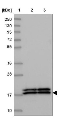 NM23-H1 Antibody, Novus Biologicals:Antibodies:Primary Antibodies
