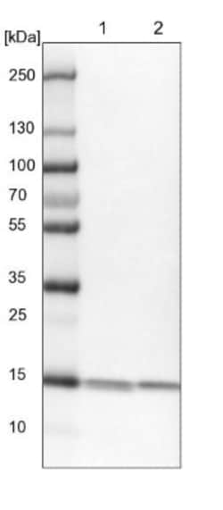 NM23-H1 Antibody, Novus Biologicals:Antibodies:Primary Antibodies