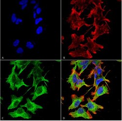 NMDAR1 Antibody (S308-48), Novus Biologicals:Antibodies:Primary Antibodies