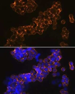 NMDAR1 Rabbit anti-Human, Mouse, Rat, Clone: 1H1T3, Novus Biologicals 100