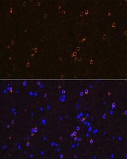 NMDAR1 Rabbit anti-Human, Mouse, Rat, Clone: 1H1T3, Novus Biologicals 100
