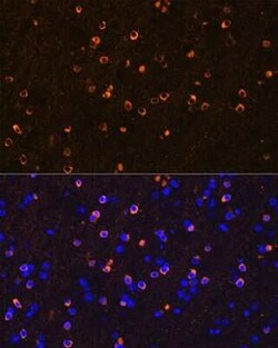 NMDAR1 Rabbit anti-Human, Mouse, Rat, Clone: 1H1T3, Novus Biologicals 100
