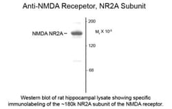 NMDAR2A Antibody, Novus Biologicals 100 &mu;L | Buy Online | Novus Biologicals | Fisher Scientific