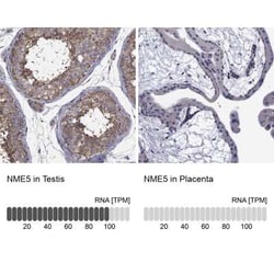 NME5 Rabbit anti-Human, Polyclonal, Novus Biologicals 100 &mu;g; Unconjugated:Antibodies,