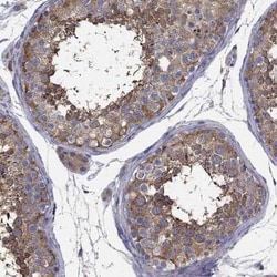 NME5 Rabbit anti-Human, Polyclonal, Novus Biologicals 100 &mu;g; Unconjugated:Antibodies,
