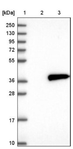 NMRAL1 Antibody, Novus Biologicals 0.1 mL | Buy Online | Novus Biologicals | Fisher Scientific