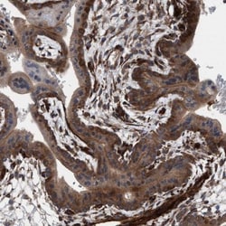 NMT1 Antibody, Novus Biologicals:Antibodies:Primary Antibodies