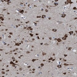 NMT1 Antibody, Novus Biologicals:Antibodies:Primary Antibodies