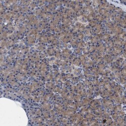 NMT1 Antibody, Novus Biologicals:Antibodies:Primary Antibodies